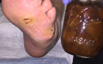 The Price of Figs and The Gift of Pain