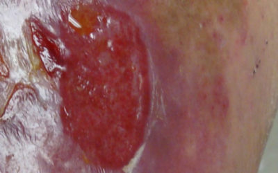 Don’t Miss This: The Epithelial Light Reflex