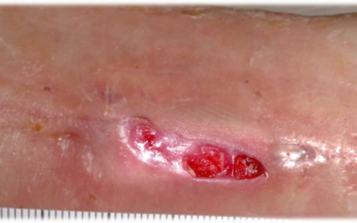 Watch Epithelium "Think"