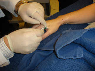 Attend the Virtual Lymphedema Seminar on October 3rd