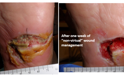 Virtually Disappointing Wound Management