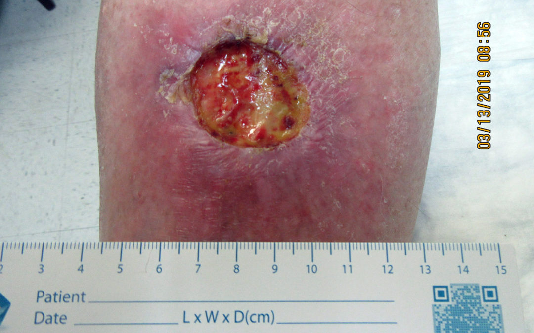 Another New Case for “Stop the Madness of Shin Radiation”