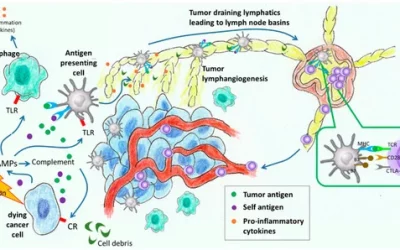 New Review Article Just Out: The Development and Treatment of Lymphatic Dysfunction in Cancer Patients & Survivors