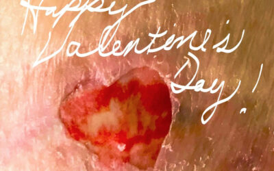 Happy Valentine’s Day to All the Wound Warriors!