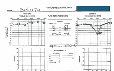 The National Hearing Test – a Follow Up on the “Do it Yourself” Hearing Test