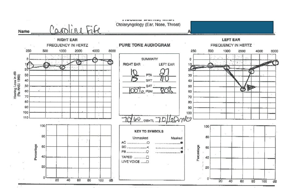 The National Hearing Test – a Follow Up on the “Do it Yourself” Hearing Test