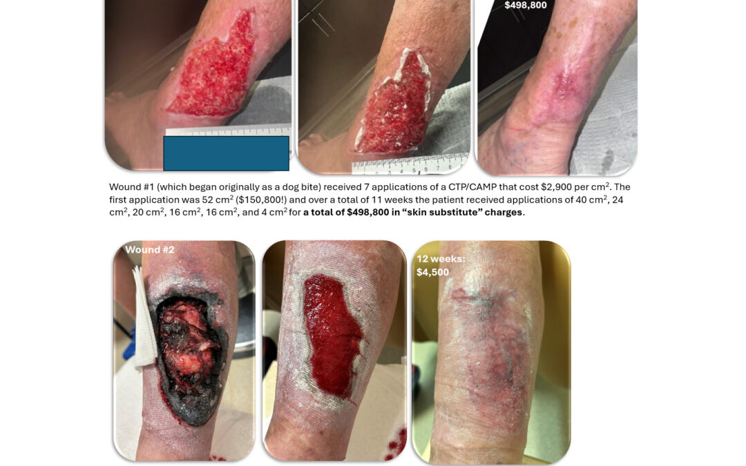 A Follow Up on the “Tale of Two Wounds” and the Madness of Skin Sub Pricing