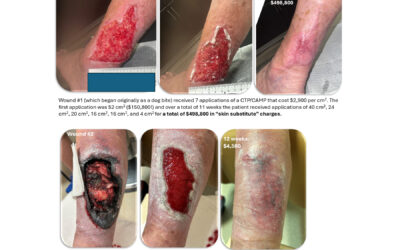 A Follow Up on the “Tale of Two Wounds” and the Madness of Skin Sub Pricing