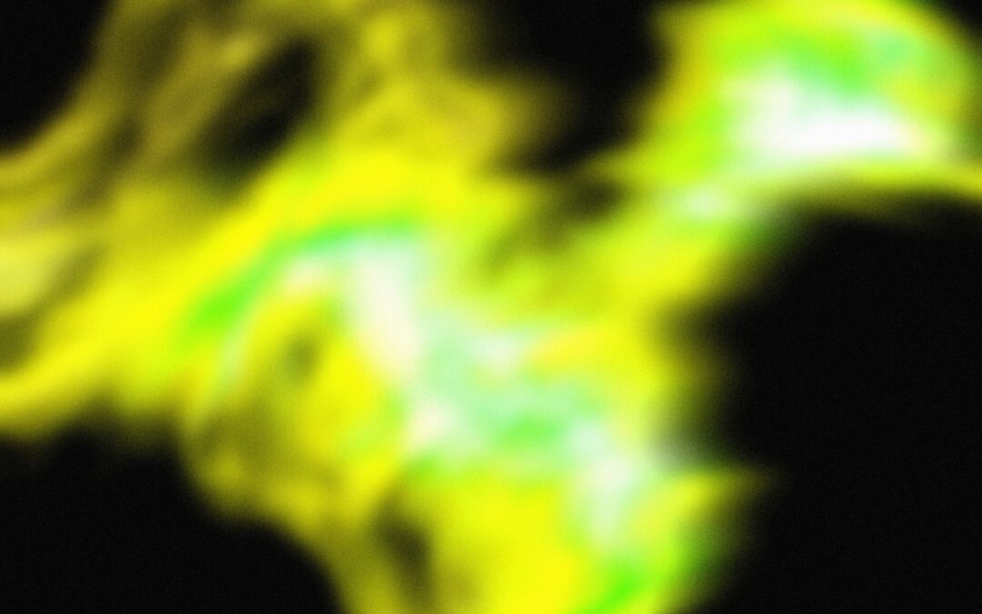 MACs Propose Non-Coverage of Fluorescence Wound Imaging